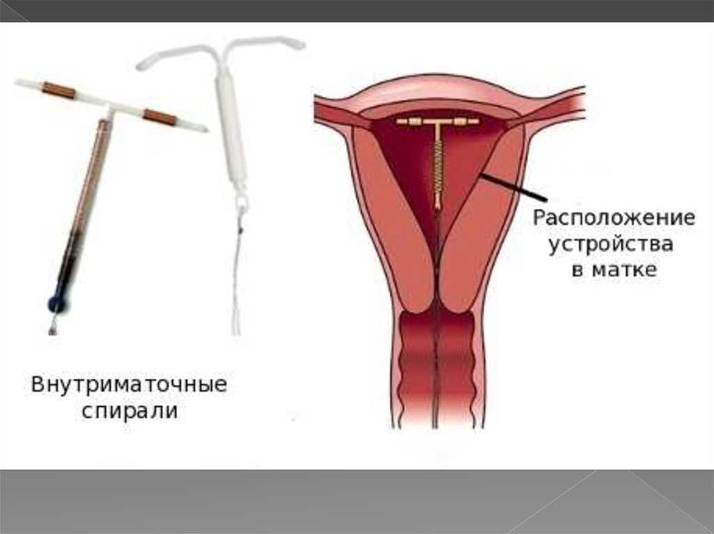Гормональные противозачаточные контрацептивы для женщин