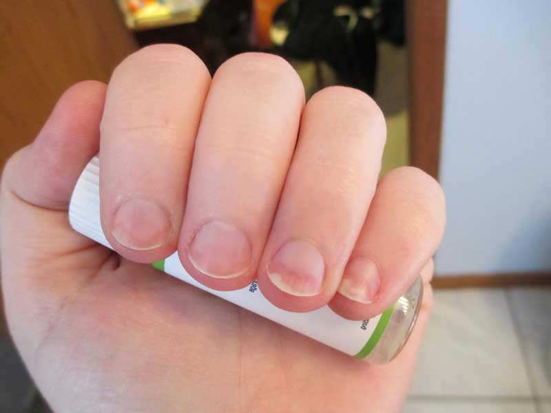 Как ухаживать за ломкими ногтями