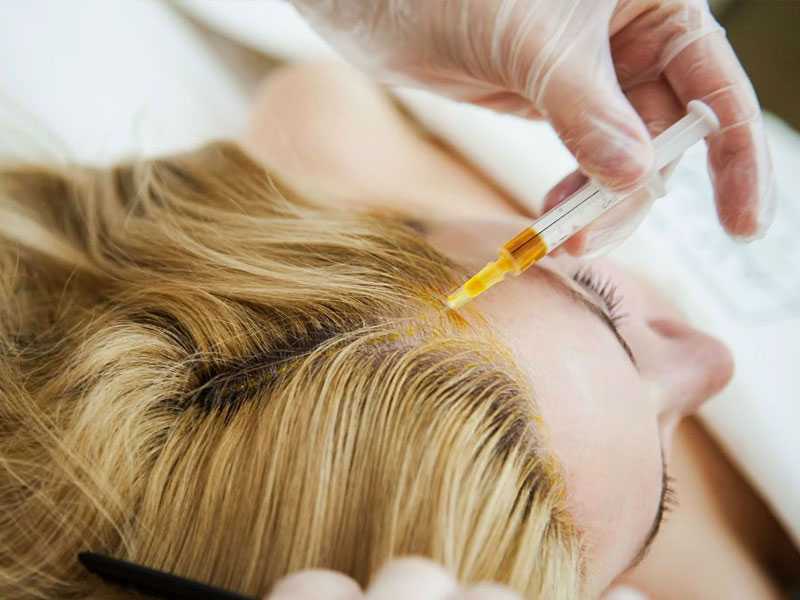 Восстановление волос с помощью мезотерапии