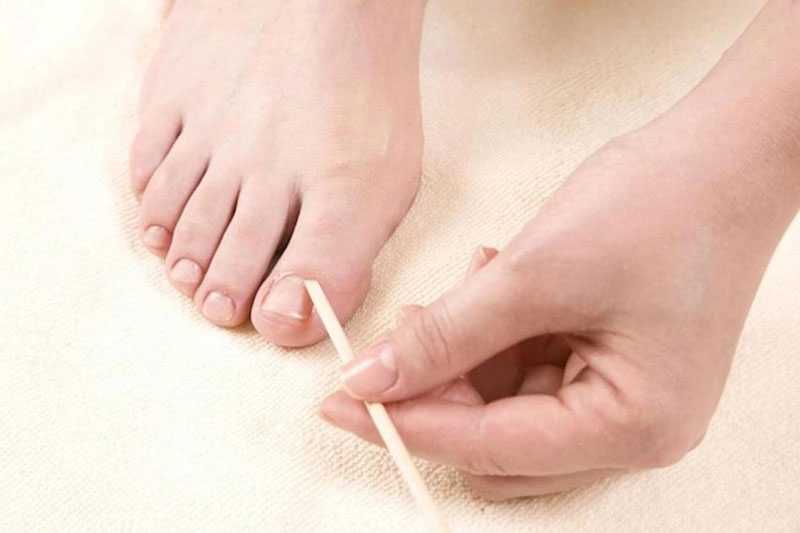 Чем размягчить ногти на ногах у пожилых людей перед стрижкой в домашних условиях фото пошагово